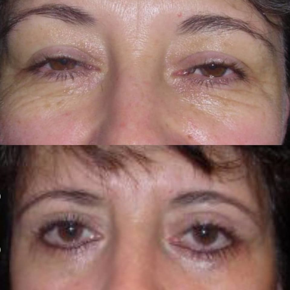 Dr. Jairo Zalamea Silva - Cirugía Plástica