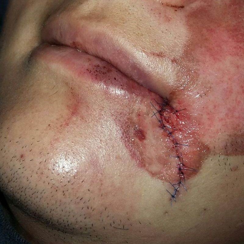 Cirugía Reconstructiva